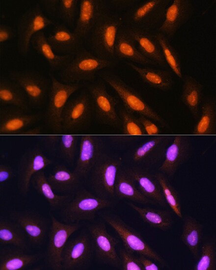 Protein Phosphatase 1 beta Antibody
