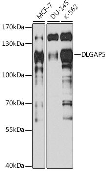 DLG7/HURP Antibody