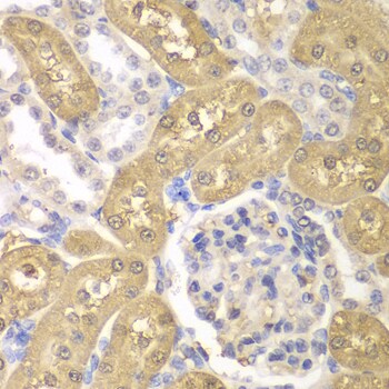 AKR1A1 Antibody