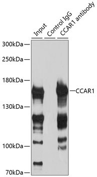 CCAR1 Antibody