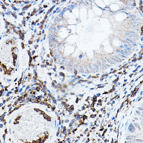 PKC beta Antibody