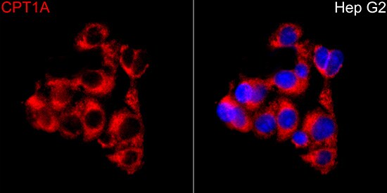 CPT1A Antibody