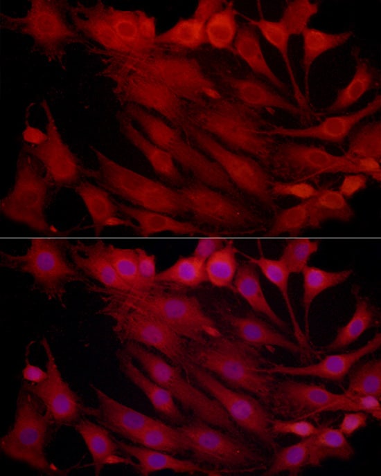 Proteasome 20S beta2 Antibody