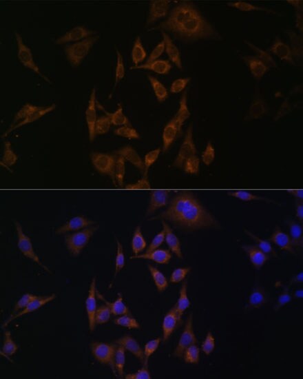 UbcH8/Ube2L6 Antibody