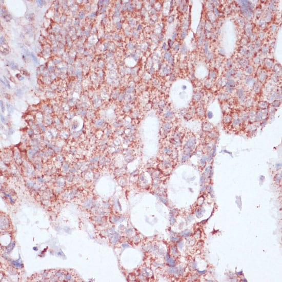 RPL30 Antibody