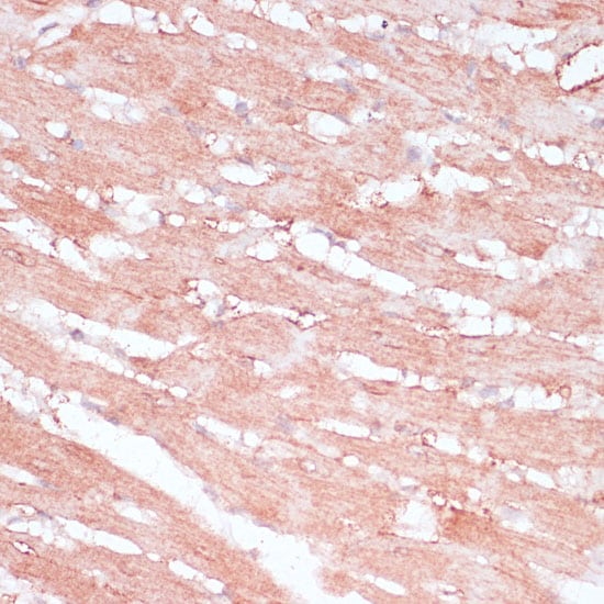 RPL30 Antibody