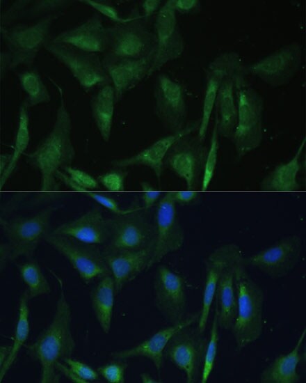 CAMLG Antibody