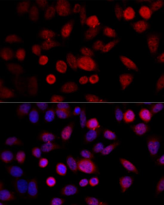 CYP1B1 Antibody