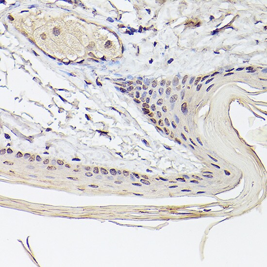 Pea3 Antibody