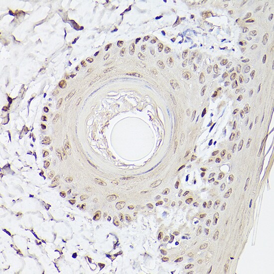Pea3 Antibody