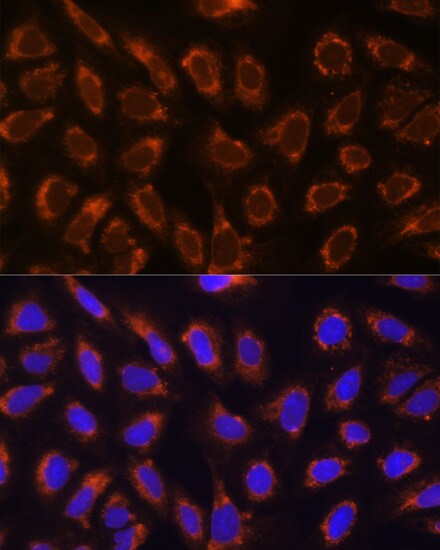 alpha Glucosidase 2 Antibody