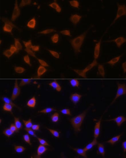 alpha Glucosidase 2 Antibody