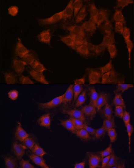 alpha Glucosidase 2 Antibody