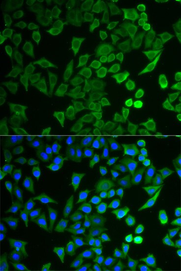 TUSC4 Antibody