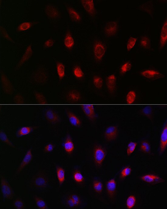GNB3 Antibody