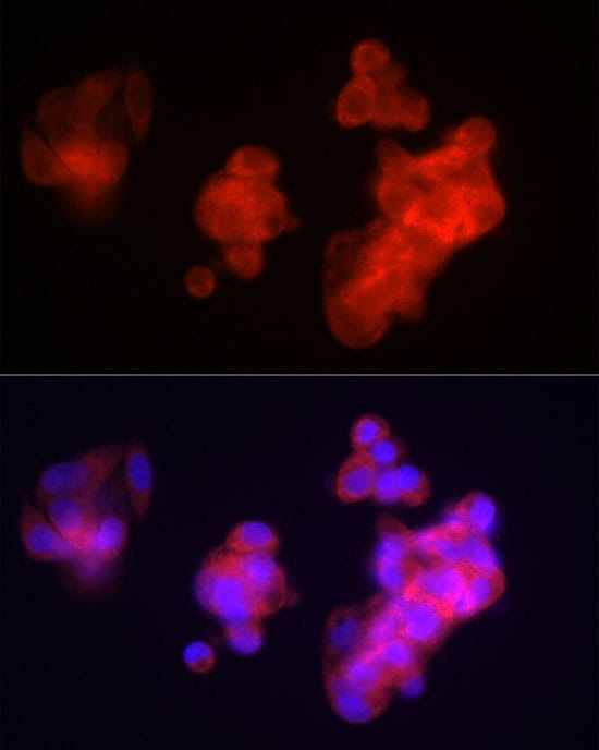 Fibrinopeptide B Antibody