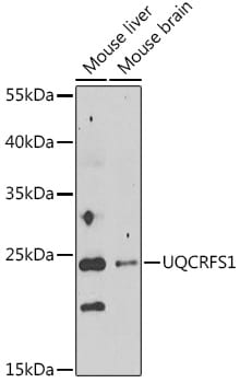 UQCRFS1 Antibody