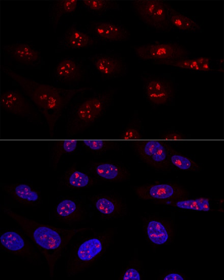 NOP58 Antibody