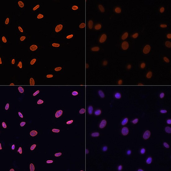 H4 Clustered Histone 1 [ac Lys12] Antibody