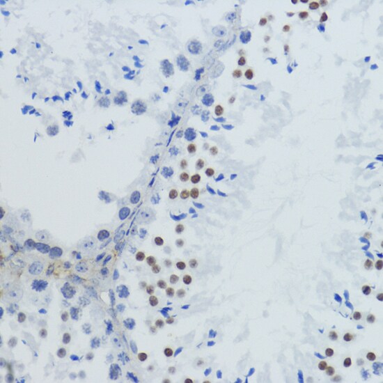 H4 Clustered Histone 1 [ac Lys12] Antibody
