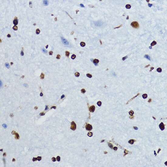 H4 Clustered Histone 1 [ac Lys12] Antibody