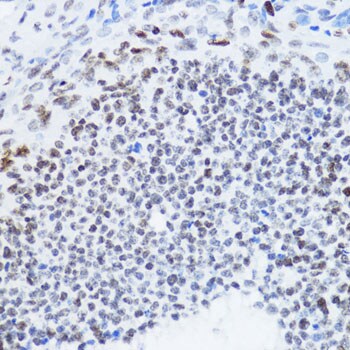 H4 Clustered Histone 1 [ac Lys12] Antibody