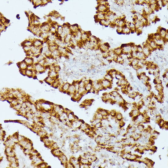 HMGCS2 Antibody