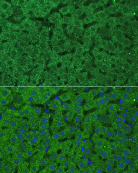 CBS Antibody