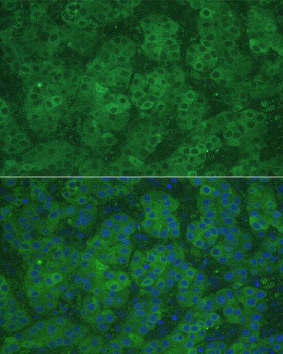 CBS Antibody