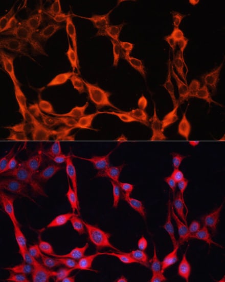 SLC25A23 Antibody