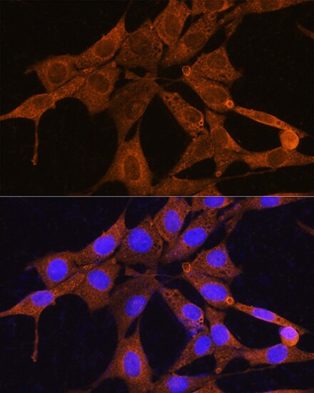 NMNAT3 Antibody