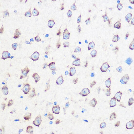 Calmodulin 3 Antibody