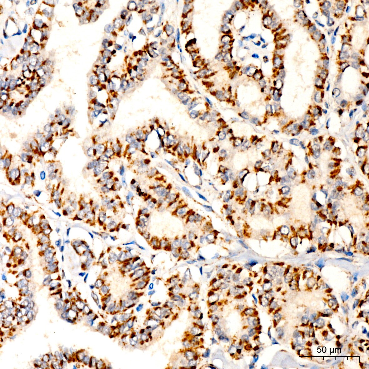 Pyruvate Dehydrogenase E2 Antibody