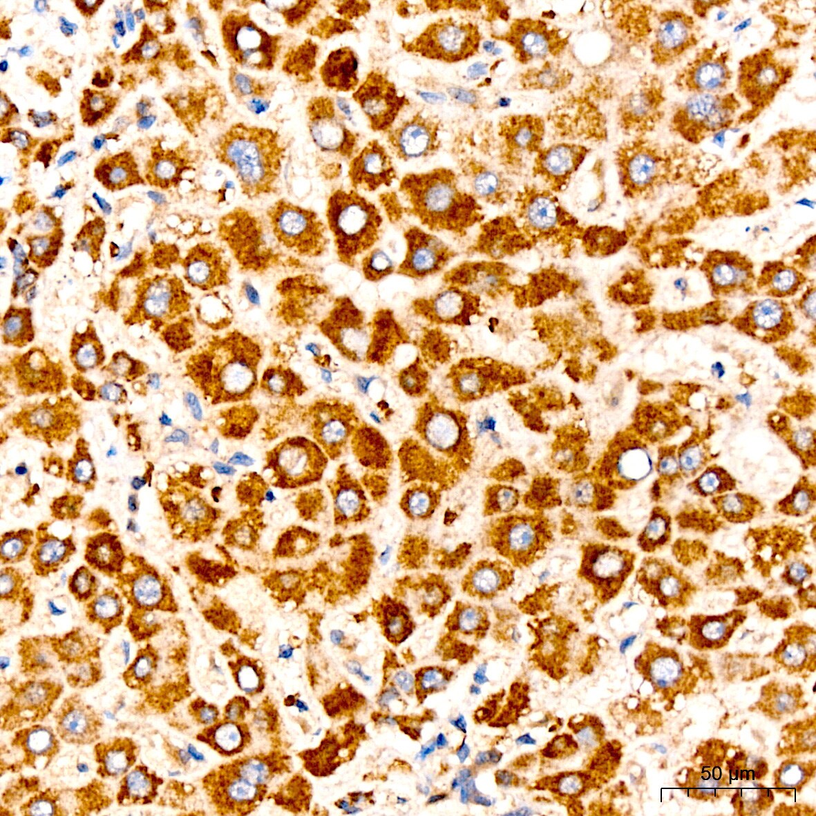 Pyruvate Dehydrogenase E2 Antibody