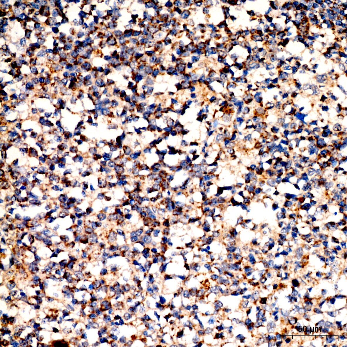 Pyruvate Dehydrogenase E2 Antibody