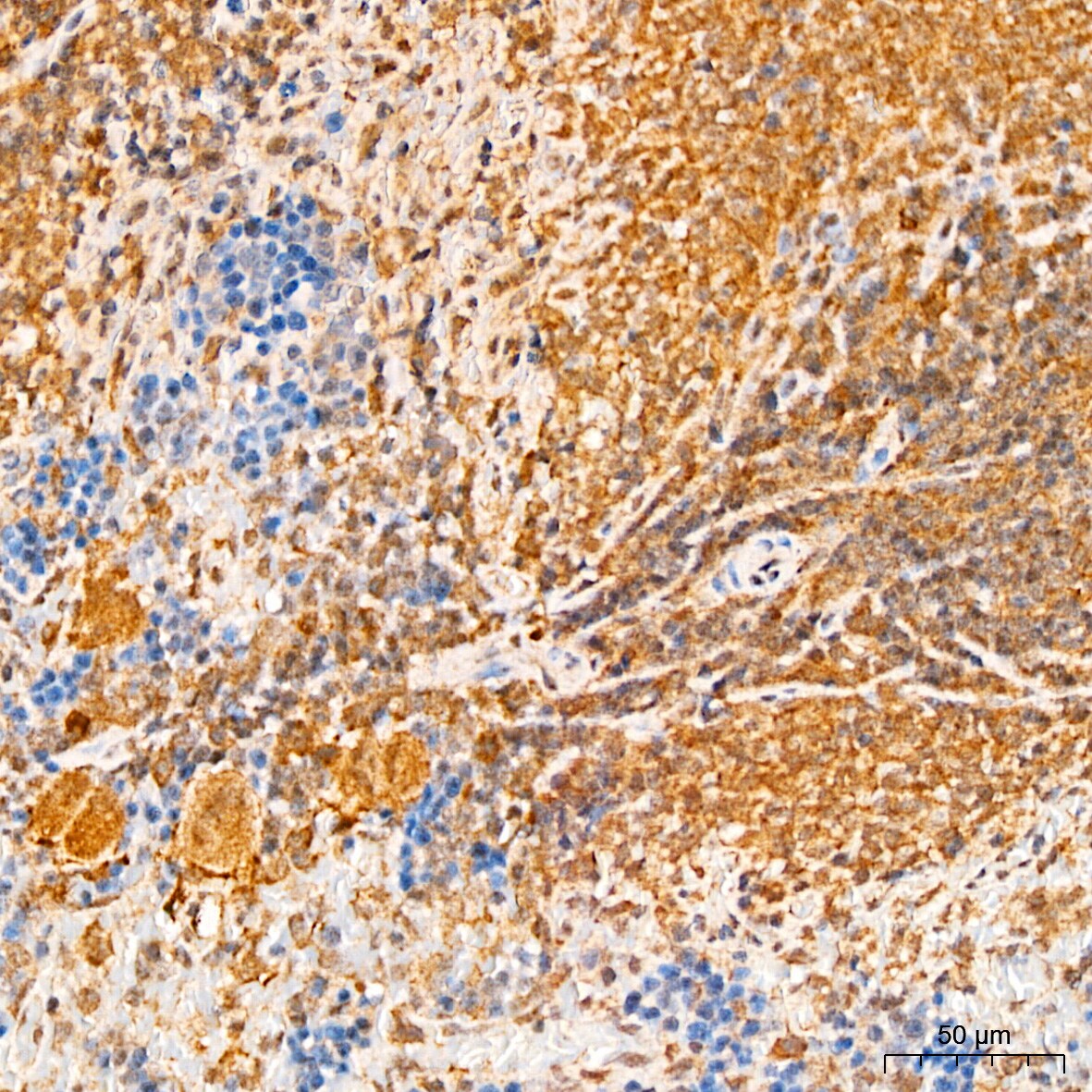 APOBEC3G Antibody