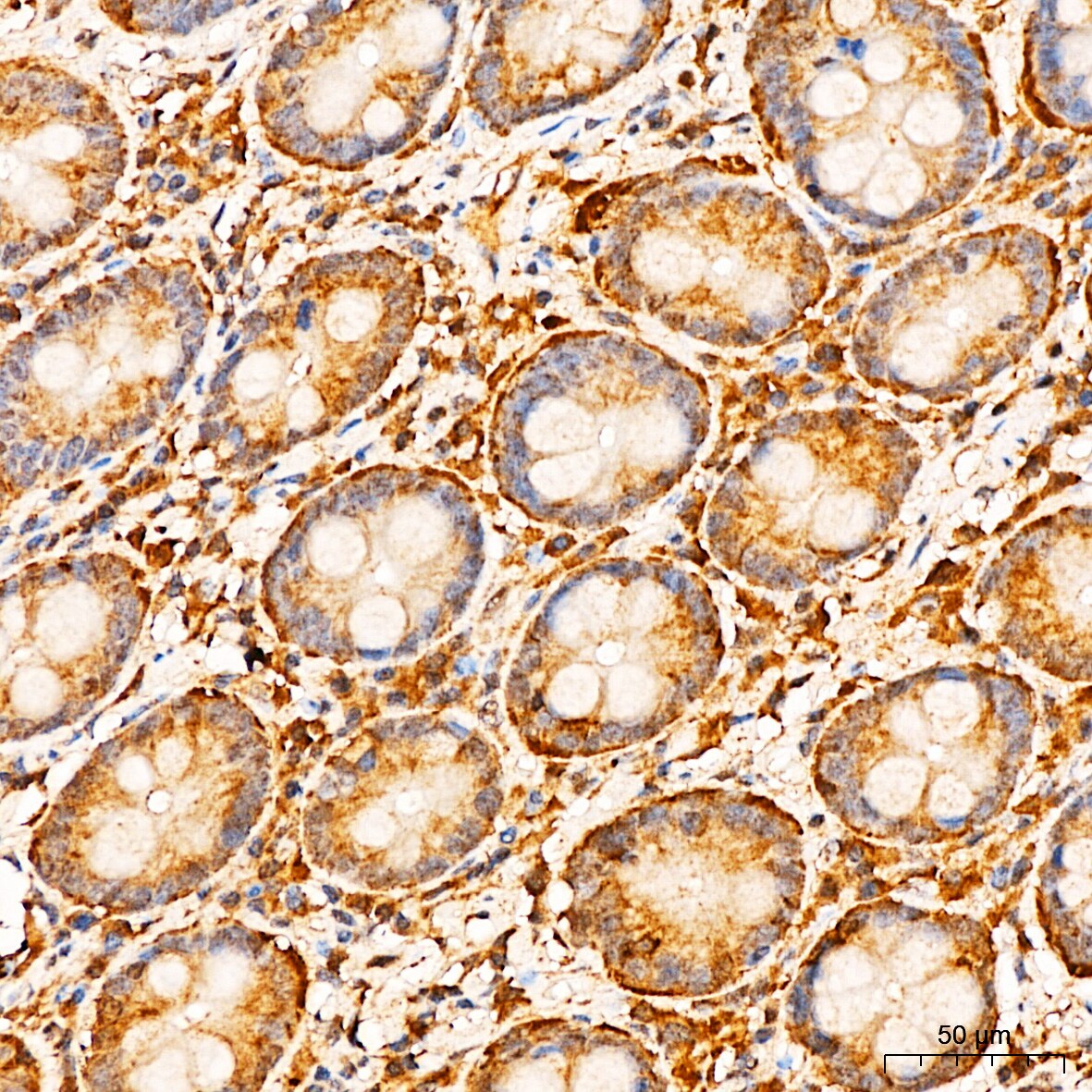 APOBEC3G Antibody