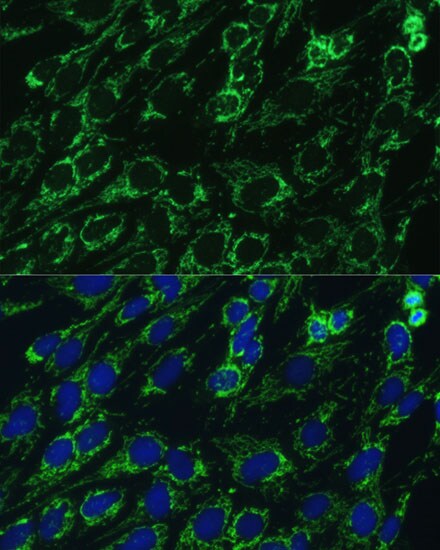 IDH3A Antibody