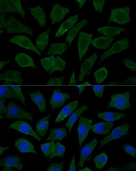 COX15 Antibody
