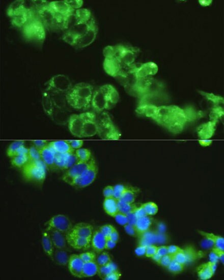 Golgin 97 Antibody