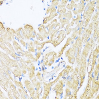 12-Lipoxygenase Antibody