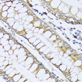 12-Lipoxygenase Antibody