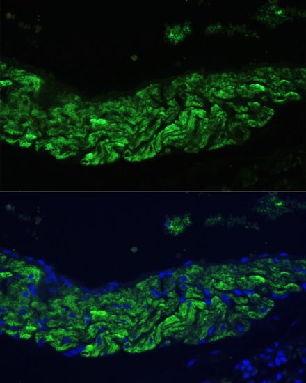 12-Lipoxygenase Antibody