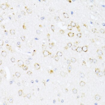 12-Lipoxygenase Antibody