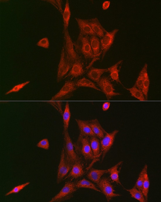 NFkB p105/p50 Antibody