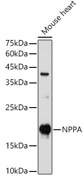 Atrial Natriuretic Peptide/ANP Antibody