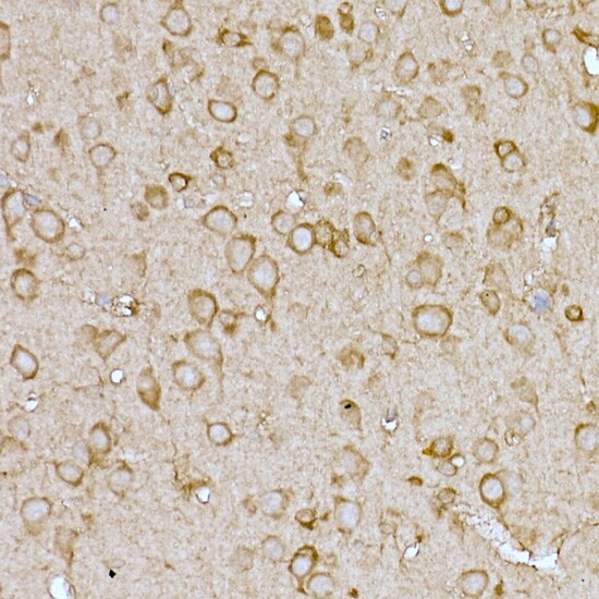 CAT1 Antibody