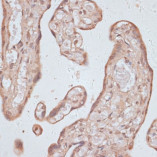 TLK1 Antibody