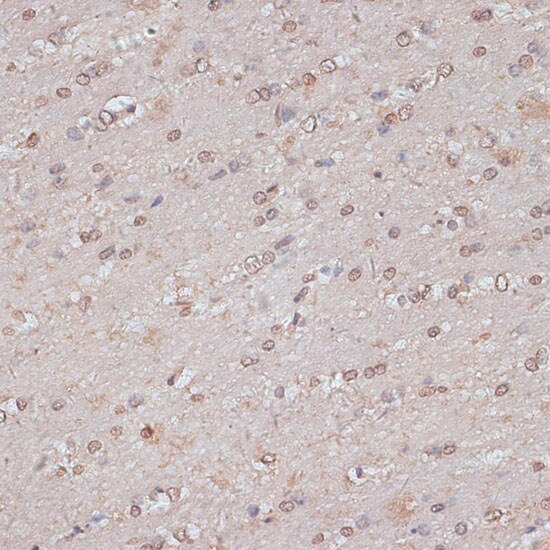 TLK1 Antibody