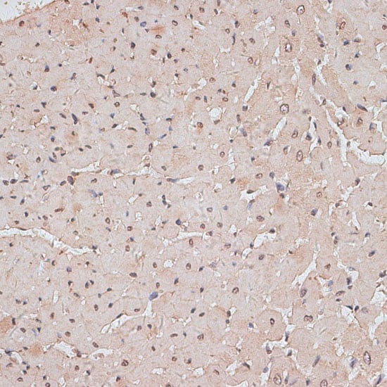 TLK1 Antibody